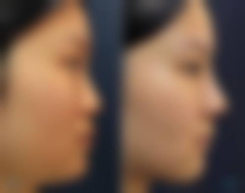 患者真实评价