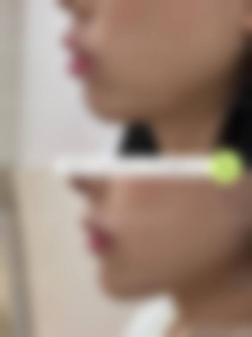 哈尔滨第二医院整形外科擅长项目。
