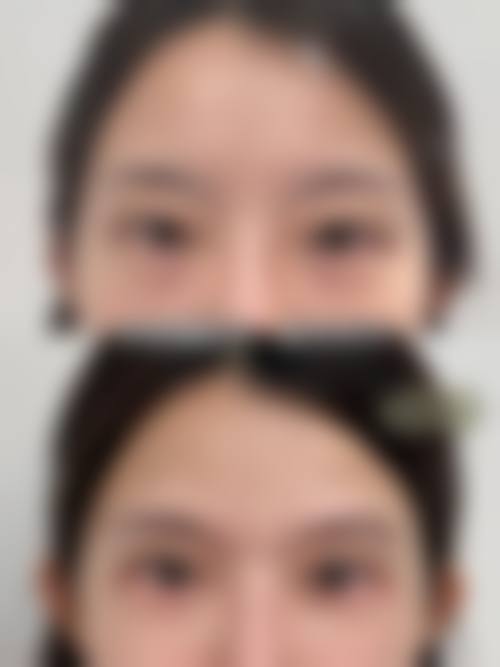 南溪山医院整形美容外科水桶腰吸脂手术优势明显。