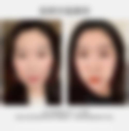 广西区人民医院美容整形外科治疗反馈与口碑评价。