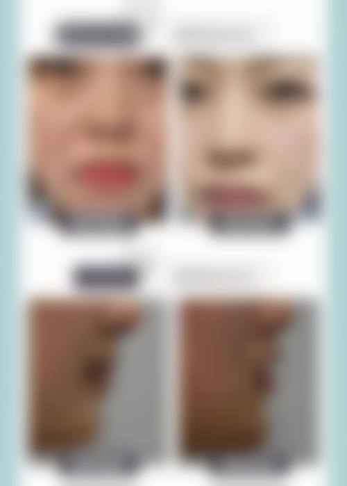 广西区人民医院美容整形外科擅长项目。