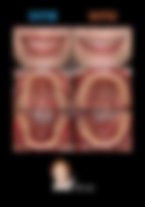 临床实例分享