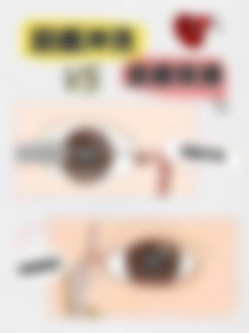 预约到院,重获清晰视界