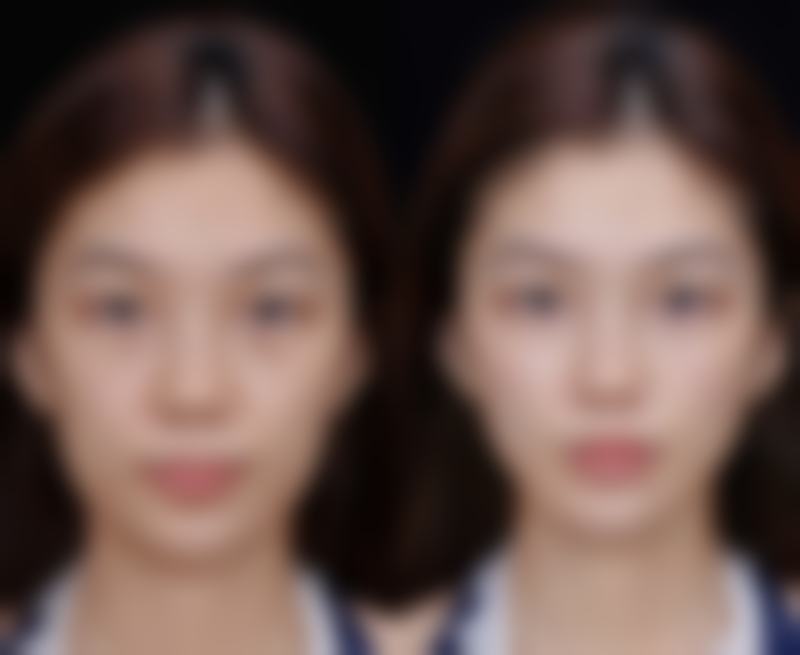 宝鸡美瑞拉医疗美容诊所口碑如何?